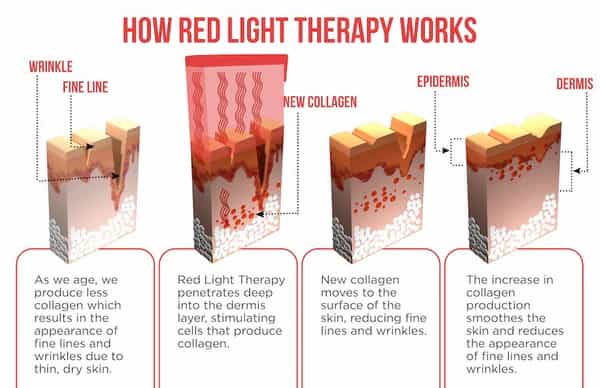 Red Light Therapy with the Solawave Wand